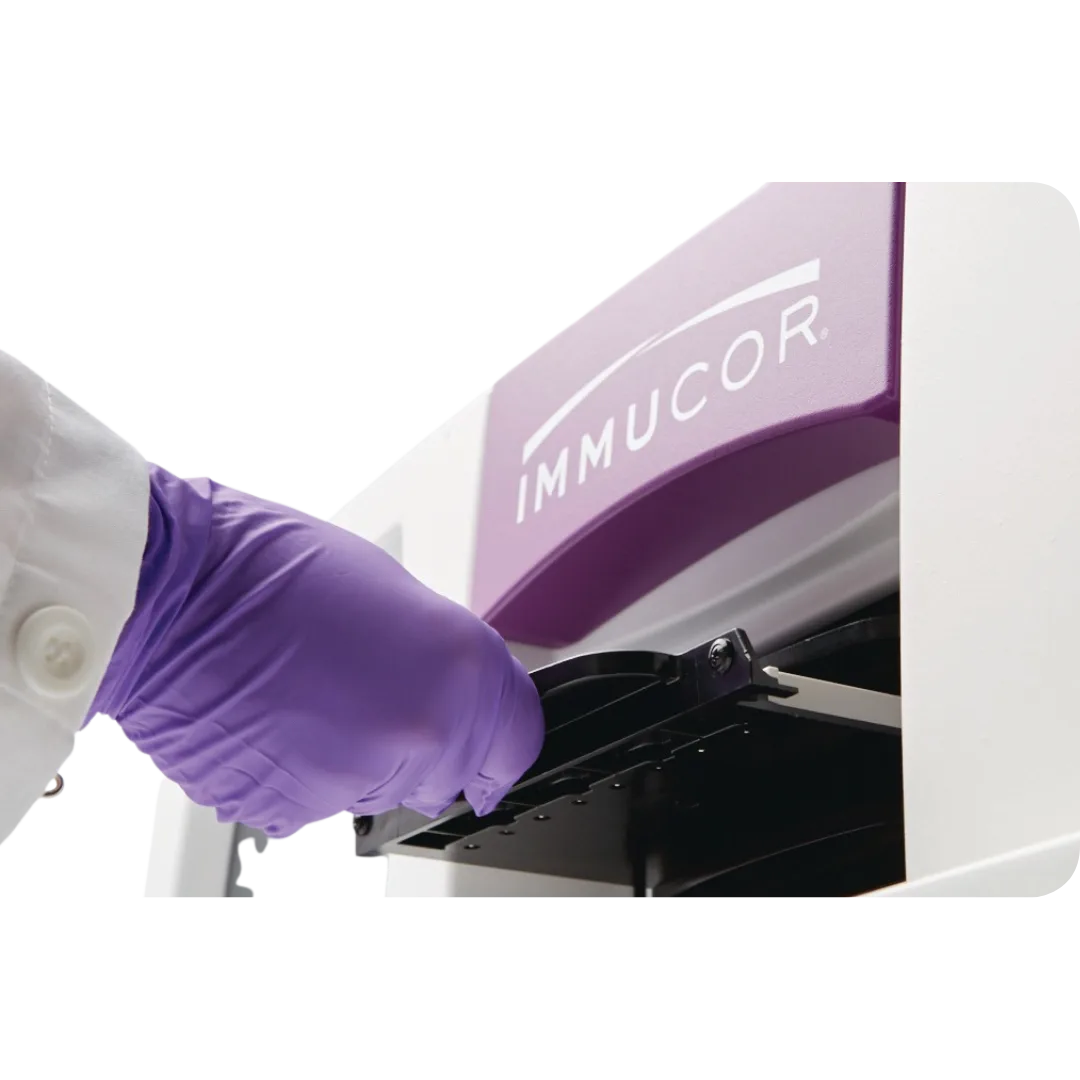 Echo Lumena® – NG MED